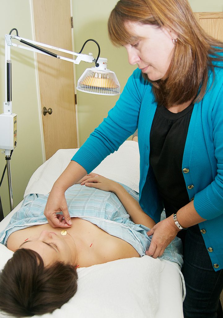 Amy performing Acupuncture treatment