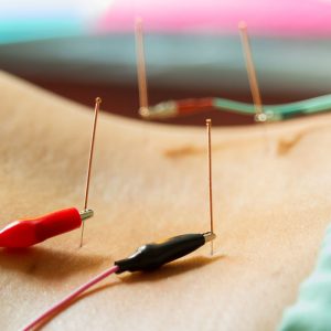 electro acupuncture